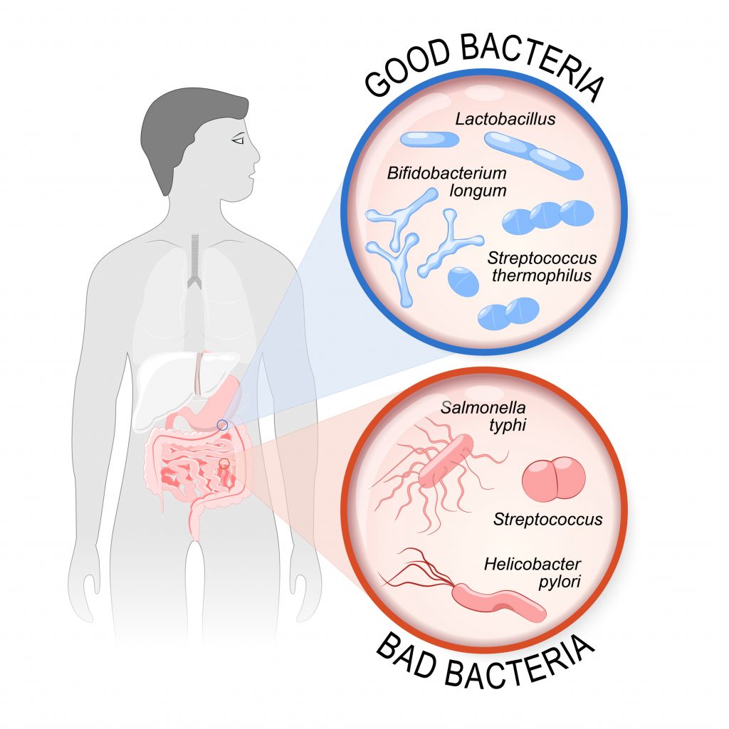 Good and bad bacteria within your gut which can affect your mood including depression - gut bacteria cause depression