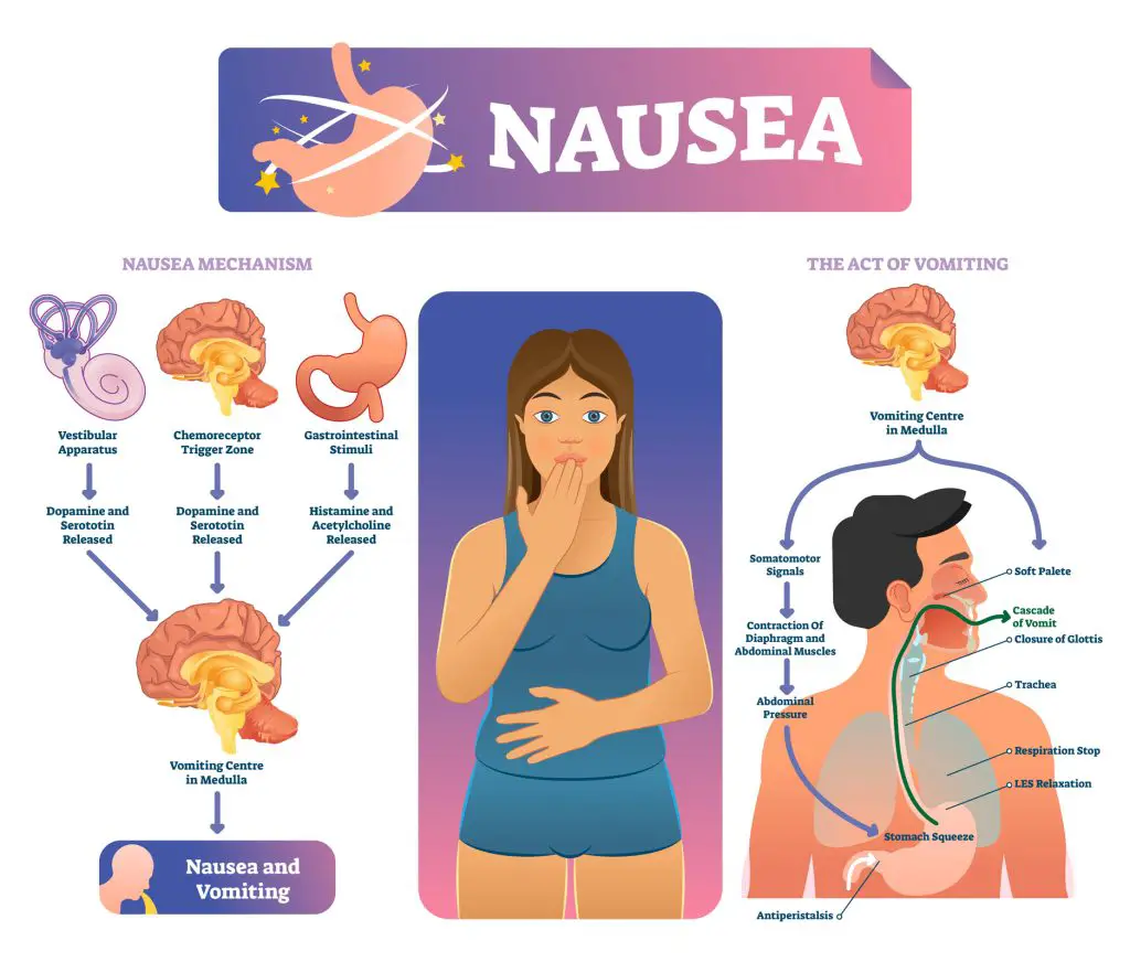 Anatomical infographic with inner organs reaction to trigger bad stomach feeling - do probiotics make you nauseous