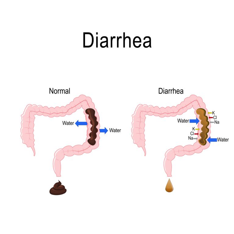 do-probiotics-help-with-diarrhea