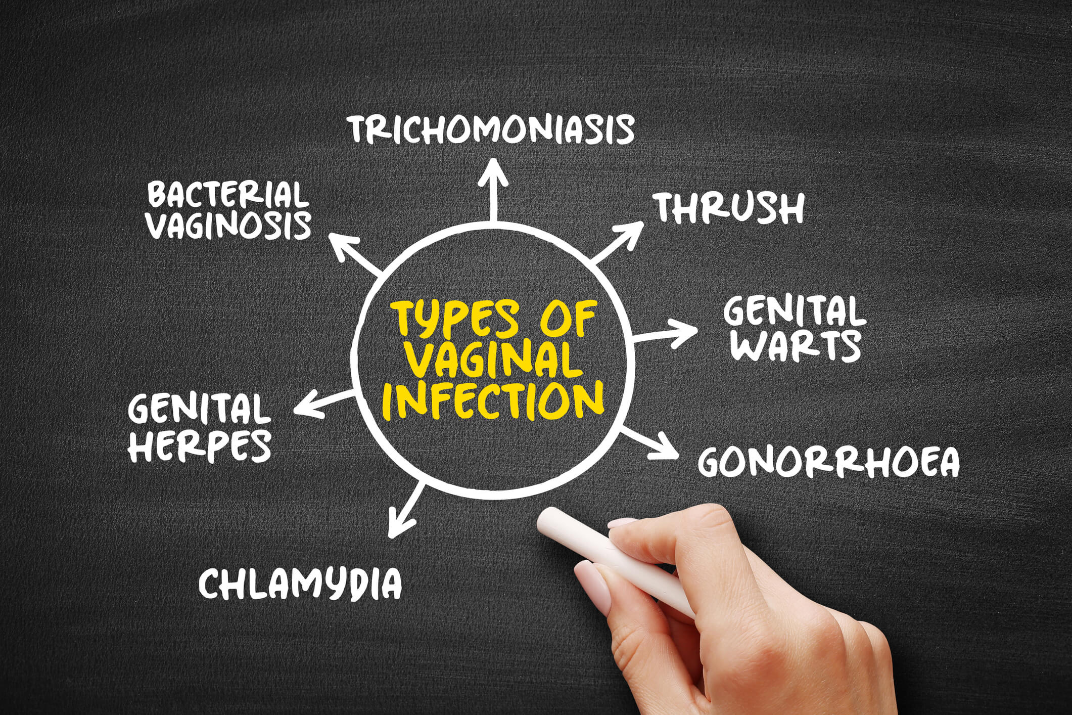 Using Probiotics For Vaginal Yeast Infections Probiotics Tips